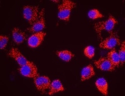 Xrn1 Antibody, Novus Biologicals 0.1mL; Unlabeled:Antibodies, Polyclonal