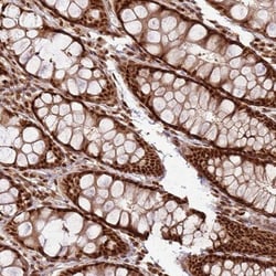 XRN2 Antibody, Novus Biologicals 25 &mu;L, Unlabeled:Antibodies, Polyclonal