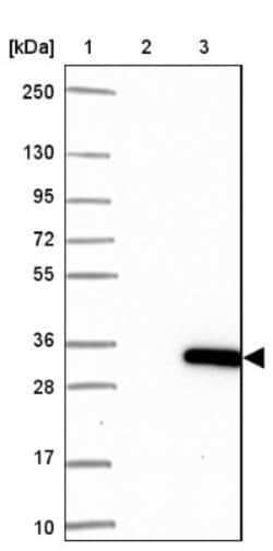 XTP12 Antibody, Novus Biologicals 0.1mL; Unlabeled:Antibodies, Polyclonal