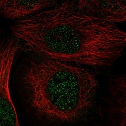 Xylulokinase/XYLB Antibody, Novus Biologicals 0.1mL; Unlabeled:Antibodies,