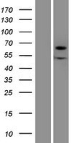 Novus Biologicals&trade;&nbsp;Xylulokinase/XYLB Overexpression Lysate