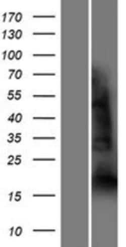 Novus Biologicals&trade;&nbsp;YAF2 Overexpression Lysate