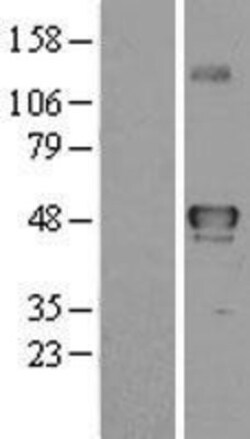 Novus Biologicals&trade;&nbsp;YANK2 Overexpression Lysate