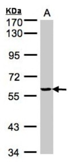 YARS Antibody, Novus Biologicals 0.1mL; Unlabeled:Antibodies, Polyclonal