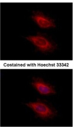YARS2 Antibody, Novus Biologicals 0.1mL; Unlabeled:Antibodies, Polyclonal