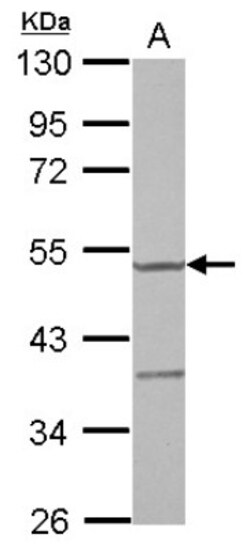 YARS2 Antibody, Novus Biologicals 0.1mL; Unlabeled:Antibodies, Polyclonal