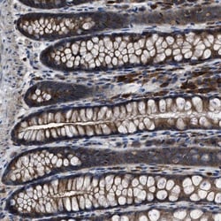 YARS Antibody, Novus Biologicals 0.1mL; Unlabeled:Antibodies, Polyclonal