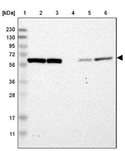 YARS Antibody, Novus Biologicals 0.1mL; Unlabeled:Antibodies, Polyclonal