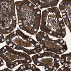 YBEY Antibody, Novus Biologicals 25 &mu;L | Buy Online | Novus Biologicals | Fisher Scientific