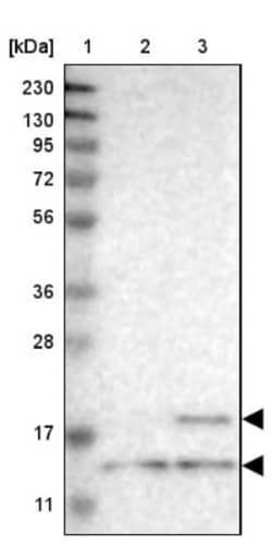 YBEY Antibody, Novus Biologicals 25 &mu;L | Buy Online | Novus Biologicals | Fisher Scientific