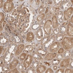 Yes Antibody, Novus Biologicals 25 &mu;L; Unlabeled:Antibodies, Polyclonal