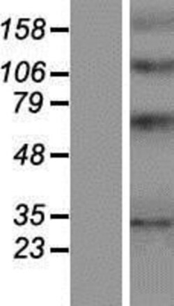 Novus Biologicals&trade;&nbsp;YIPF1 Overexpression Lysate