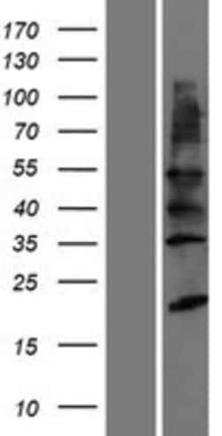 Novus Biologicals&trade;&nbsp;YIPF2 Overexpression Lysate
