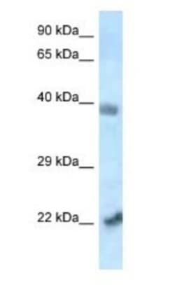YL1 Antibody, Novus Biologicals:Antibodies:Primary Antibodies