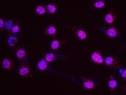 YL1 Antibody, Novus Biologicals 0.1mg; Unlabeled:Antibodies, Polyclonal