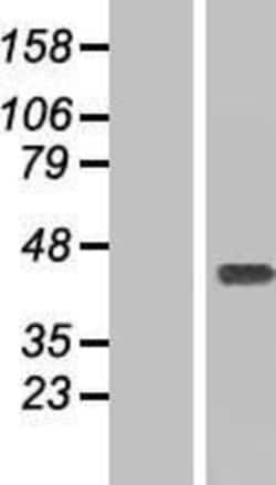 Novus Biologicals&trade;&nbsp;Ymer Overexpression Lysate