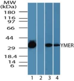 Ymer Antibody, Novus Biologicals 0.025 mg | Buy Online | Novus Biologicals | Fisher Scientific