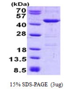 Novus Biologicals&trade;&nbsp;Recombinant Human YOD1 His Protein