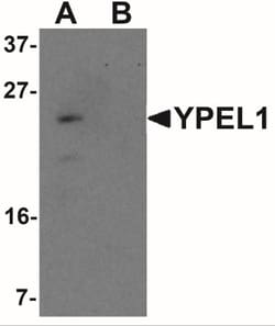 YPEL1 Antibody - BSA Free, Novus Biologicals 0.025 mg, Unlabeled:Antibodies,