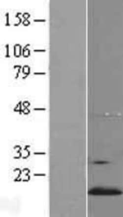 Novus Biologicals&trade;&nbsp;YPEL5 Overexpression Lysate