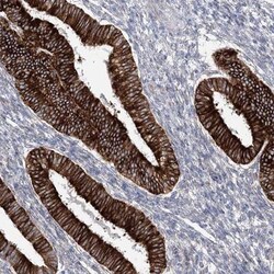 YTHDC2 Antibody, Novus Biologicals 0.1mL; Unlabeled:Antibodies, Polyclonal
