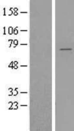 Novus Biologicals&trade;&nbsp;YTHDF2 Overexpression Lysate