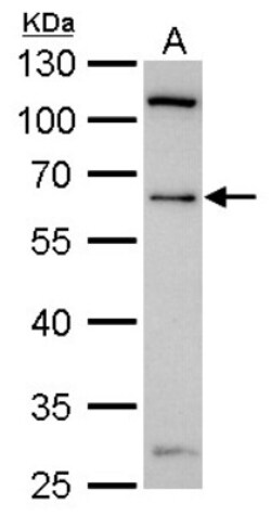 YY1 Antibody, Novus Biologicals 0.1mL; Unlabeled:Antibodies, Polyclonal