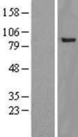 Novus Biologicals&trade;&nbsp;YY1AP1 Overexpression Lysate