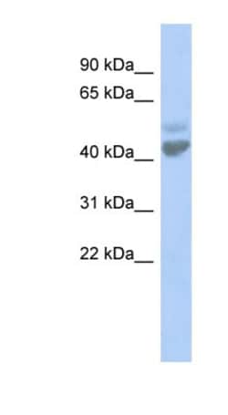 ZACN Antibody, Novus Biologicals 20μL; Unlabeled:Antibodies, Polyclonal