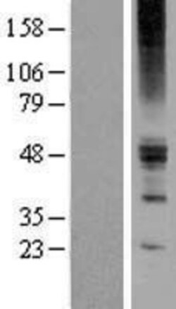 Novus Biologicals™ ZACN Overexpression Lysate