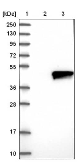 ZADH2 Antibody, Novus Biologicals 0.1mL; Unlabeled:Antibodies, Polyclonal