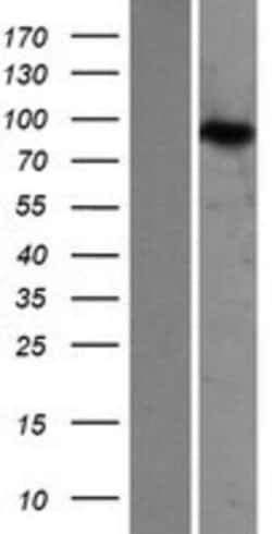 Novus Biologicals&trade;&nbsp;ZAK Overexpression Lysate