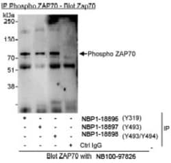 ZAP70, p Tyr494 Antibody, Novus Biologicals 100 &mu;L | Buy Online | Novus Biologicals | Fisher Scientific