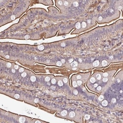 ZBED3 Antibody, Novus Biologicals:Antibodies:Primary Antibodies