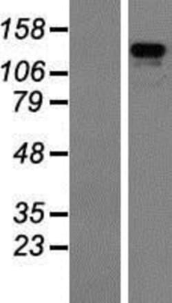 Novus Biologicals&trade;&nbsp;ZBED4 Overexpression Lysate