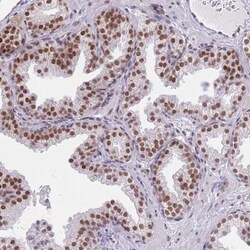 ZBED5 Antibody, Novus Biologicals 0.1mL; Unlabeled:Antibodies, Polyclonal