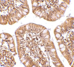 ZBP1/DLM-1/DAI Antibody - BSA Free, Novus Biologicals 0.1mg; Unlabeled:Antibodies,