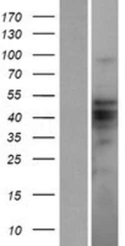 Novus Biologicals™ ZBTB12 Overexpression Lysate
