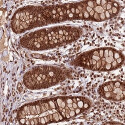 ZBTB12 Antibody, Novus Biologicals 0.1mL; Unlabeled:Antibodies, Polyclonal