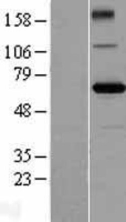 Novus Biologicals™ ZBTB2 Overexpression Lysate
