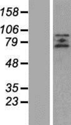 Novus Biologicals&trade;&nbsp;ZBTB20 Overexpression Lysate