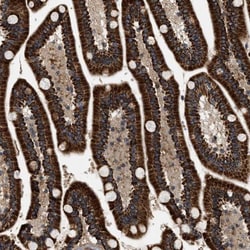 ZBTB26 Antibody, Novus Biologicals:Antibodies:Primary Antibodies