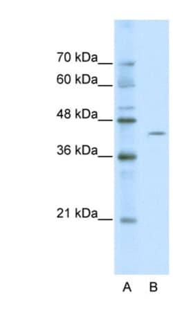ZBTB26 Antibody, Novus Biologicals 100&mu;L; Unlabeled:Antibodies, Polyclonal