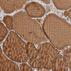ZBTB2 Antibody, Novus Biologicals 0.1mL; Unlabeled:Antibodies, Polyclonal