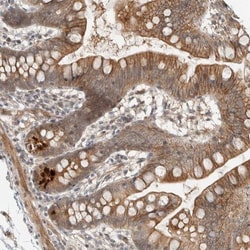ZBTB2 Antibody, Novus Biologicals:Antibodies:Primary Antibodies
