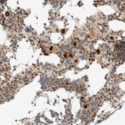 ZBTB34 Antibody, Novus Biologicals:Antibodies:Primary Antibodies