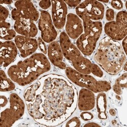 ZBTB37 Antibody, Novus Biologicals 25ul | Buy Online | Novus Biologicals | Fisher Scientific