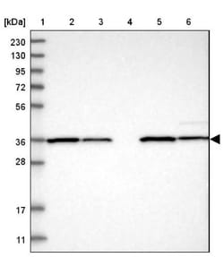 ZBTB37 Antibody, Novus Biologicals 25ul | Buy Online | Novus Biologicals | Fisher Scientific