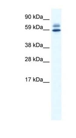 ZBTB38 Antibody, Novus Biologicals 100&mu;L; Unlabeled:Antibodies, Polyclonal