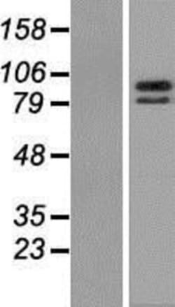 Novus Biologicals&trade;&nbsp;ZBTB39 Overexpression Lysate